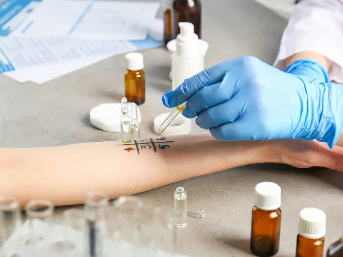 nuovo test allergie prick test